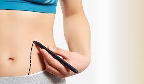 tummy tuck in Bangalore - skin and recon